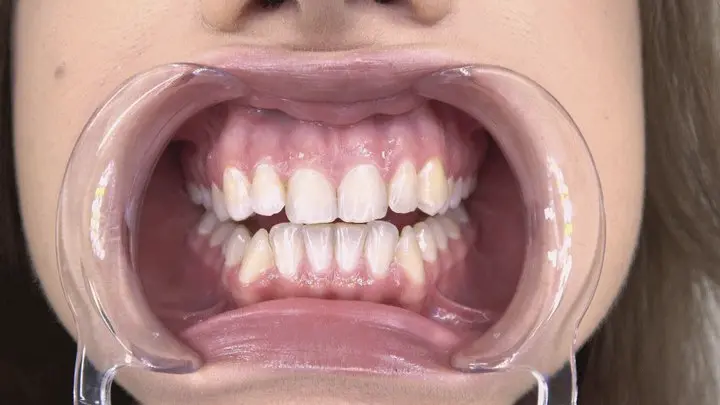 Mouth Fetish